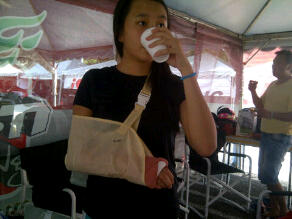kezia-retak-tangan.jpg