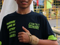 Rio Andrian Pembalap 549 Fast Performance Arya 117 masih terlihat di balut di pergelangan tanganya